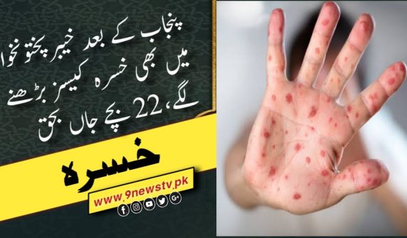 خسرہ کی بیماری