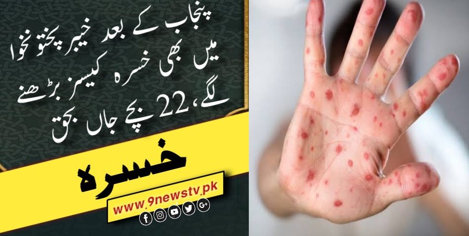 خسرہ کی بیماری